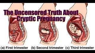 The REAL Truth About Cryptic Pregnancy [upl. by Cassaundra964]