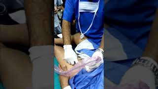 Ultrasound guided suprainguinal fascia iliaca block [upl. by Labaw]